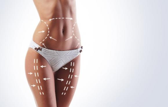 Lipocavitation cellulite